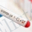 В Калмыкии за последние сутки подтверждено 121 случай COVID-19 - Elista.Org
